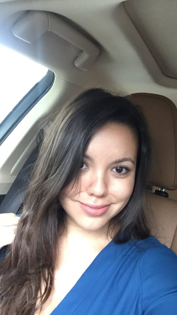 After - hydrafacial MD treatment - Girl Wonder Life